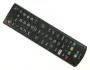 LG AKB75675302 - Fernbedienung
